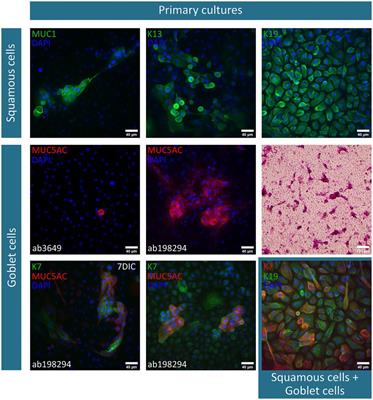 Immunocytochemical characterization of ex vivo cultured conjunctival explants; marker validation for the identification of squamous epithelial cells and goblet cells